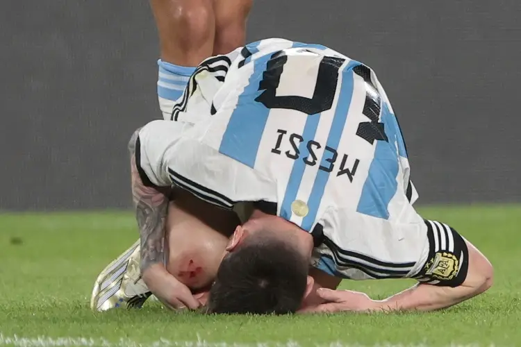 Messi termina herido tras tremenda falta (VIDEO)