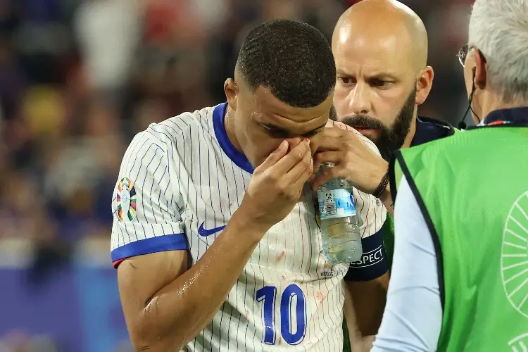 ¡Impactante! Mbappé se destroza la nariz en pleno juego de la Euro (VIDEO)