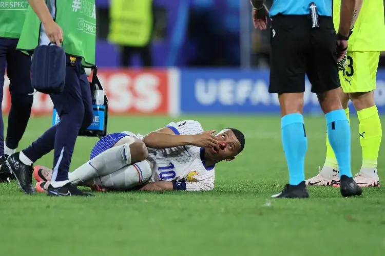 Mbappé sufre fractura en plena Euro 2024
