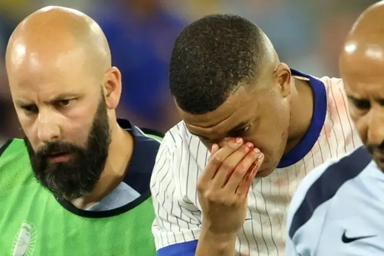 ¿Se pierde la Eurocopa? Esto se sabe sobre la fractura de Mbappé